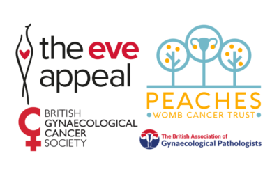 New partnership to assess variation in the management and outcomes of endometrial cancer