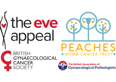 Endometrial Cancer Audit Pilot (ECAP)